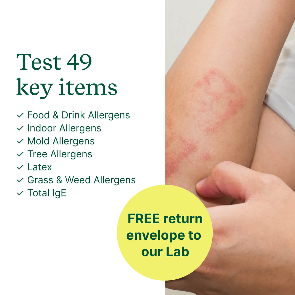 Skin Allergy Test Kit