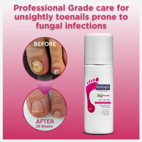 Footlogix Tintura per Unghie dei Piedi (50ml)