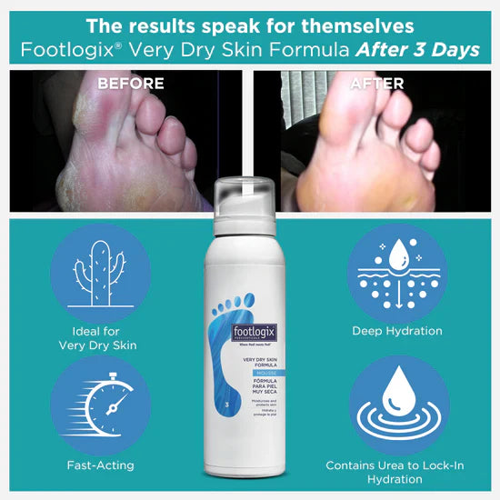 Footlogix Very Dry Skin Formula (125ml)