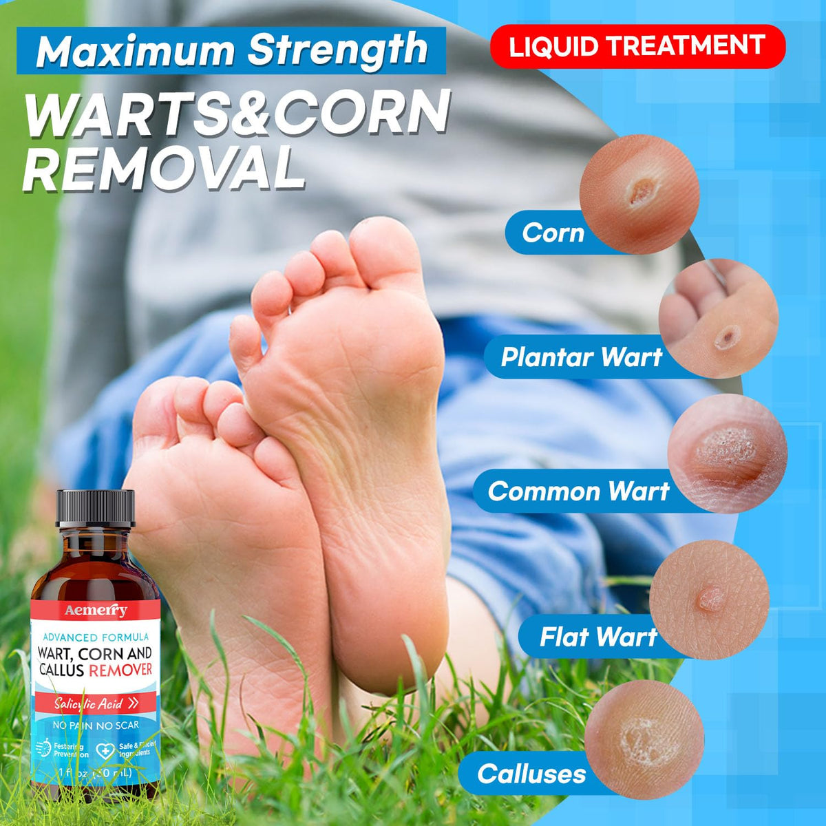 Aemerry Wart Corn Callus Remover β Maximum Strength Liquid Salicylic Acid for Feet (30ml)