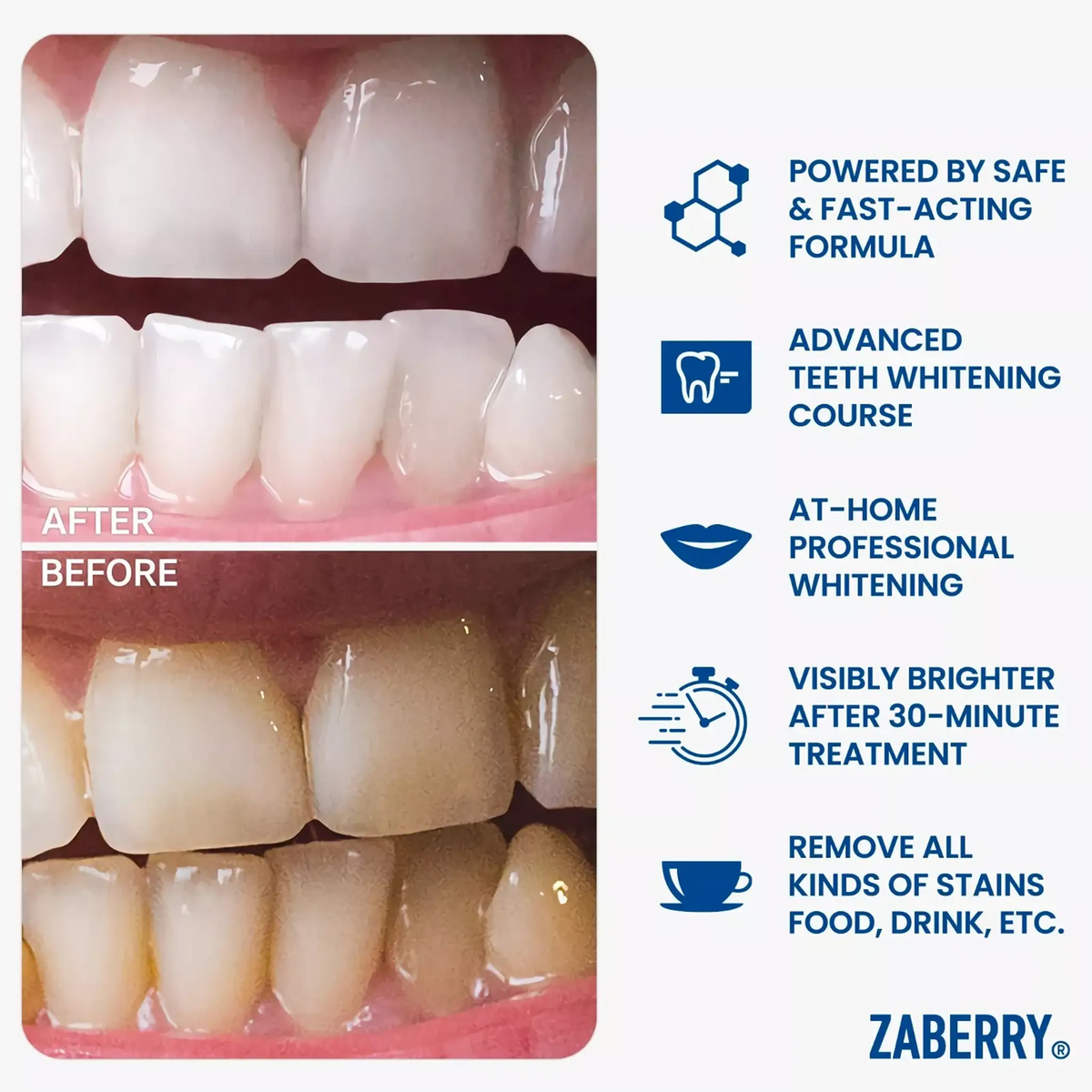 Advanced Teeth Whitening Ultimate Kit