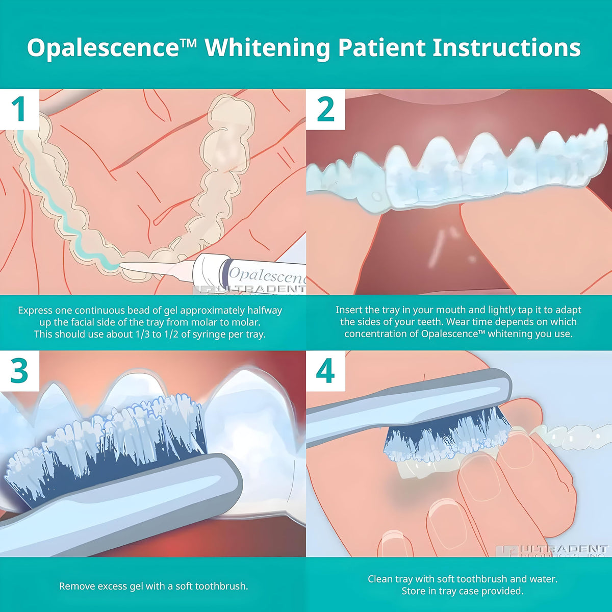 عبوات إعادة تعبئة لتبييض الأسنان Opalescence بتركيز 15% - 4 محاقن، حساسية منخفضة، بنكهة النعناع البارد - صنع في الولايات المتحدة الأمريكية (5195-2)