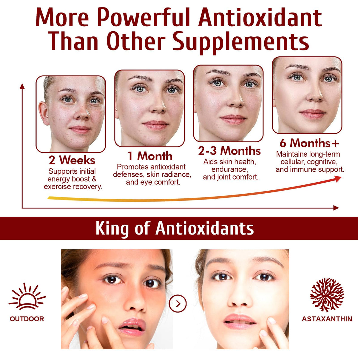 Astaxantina 12mg Softgel – Antiossidante a Tripla Concentrazione per Supporto di Occhi, Pelle, Cervello e Immunità | 120 Capsule