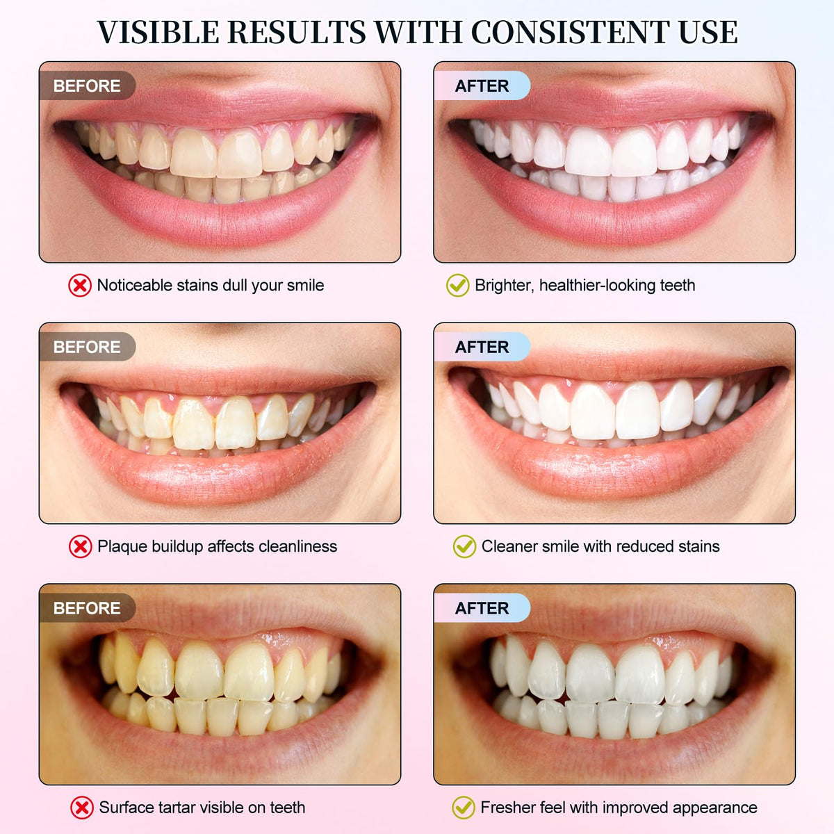 Niacinamide Whitening Toothpaste 2 Pack – Enamel Safe, Fresh Mint & Peach