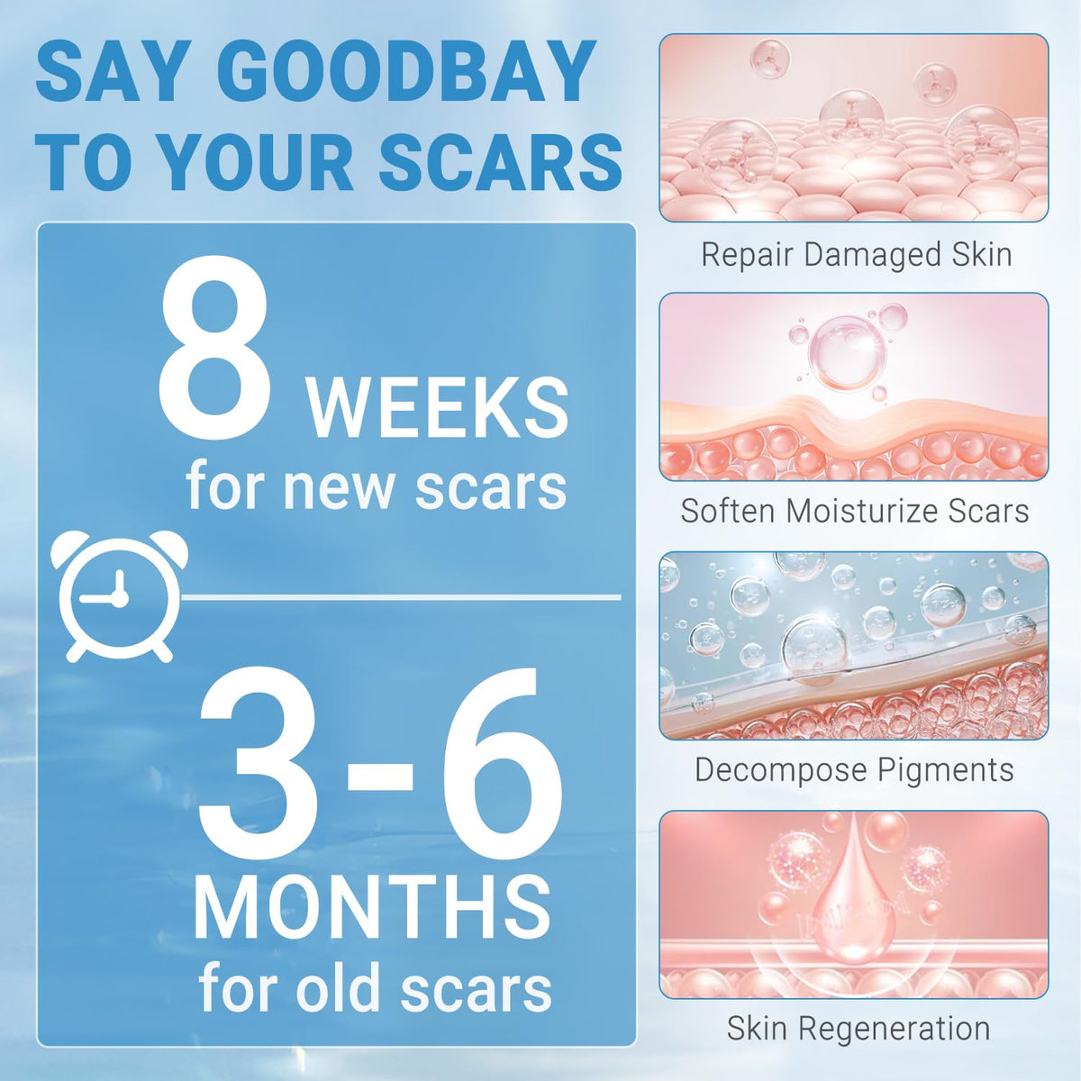 Kunyle Silicone Scar Gel – Advanced Scar Care for Surgical Scars, Keloids, and Stretch Marks | 2.11oz (60g)
