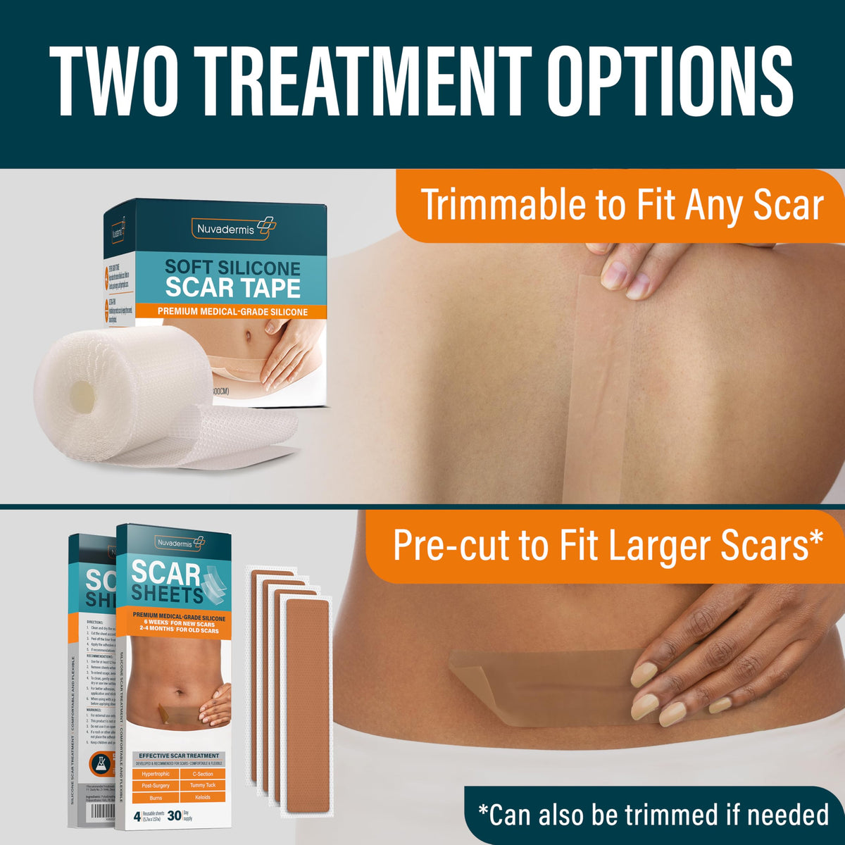 NUVADERMIS Silicone Scar Sheets – Extra Long Medical-Grade Sheets for C-Section, Tummy Tuck, Keloid & Surgical Scars – Pack of 4