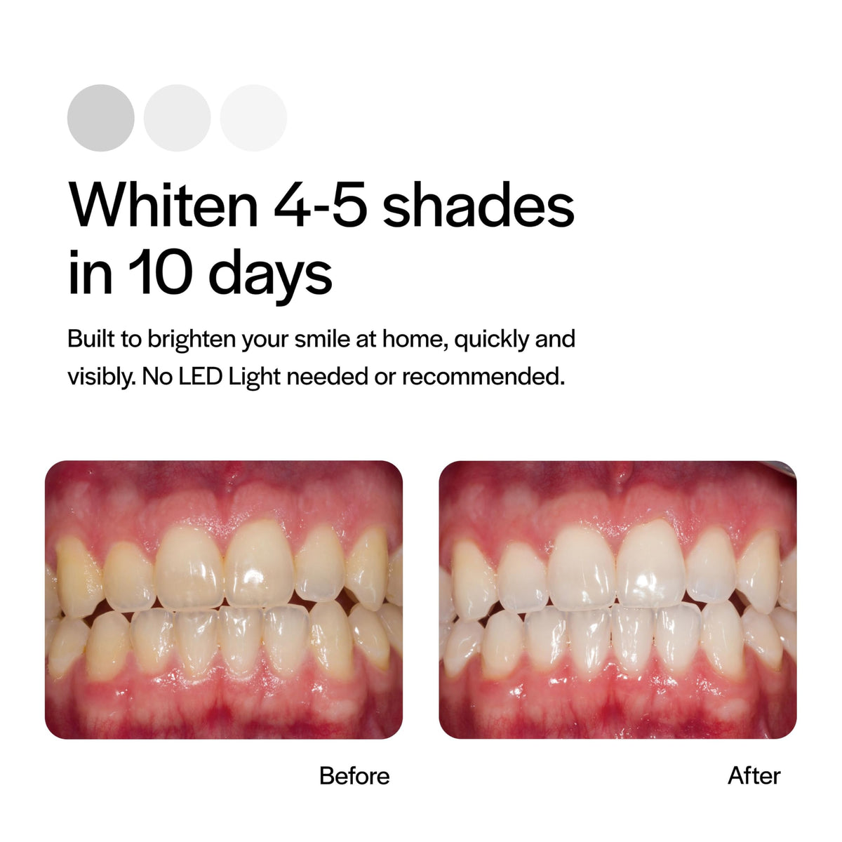 Opalescence Go 15% Mint Teeth Whitening Trays β 10 Treatments | Ultradent