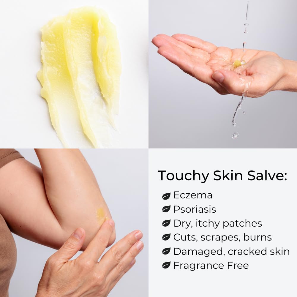 Ora's Amazing Herbal Touchy Skin Salve β Sensitive Skin Eczema Cream (4 oz)