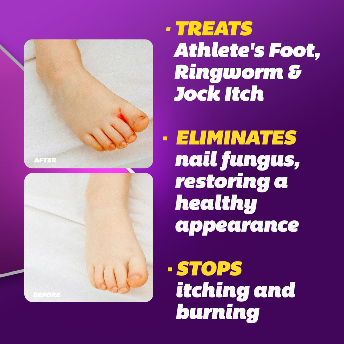 Silka Max Strength Antifungal Liquid & Cream Set β Fast Relief for Toenail Fungus, Athlete's Foot & Ringworm