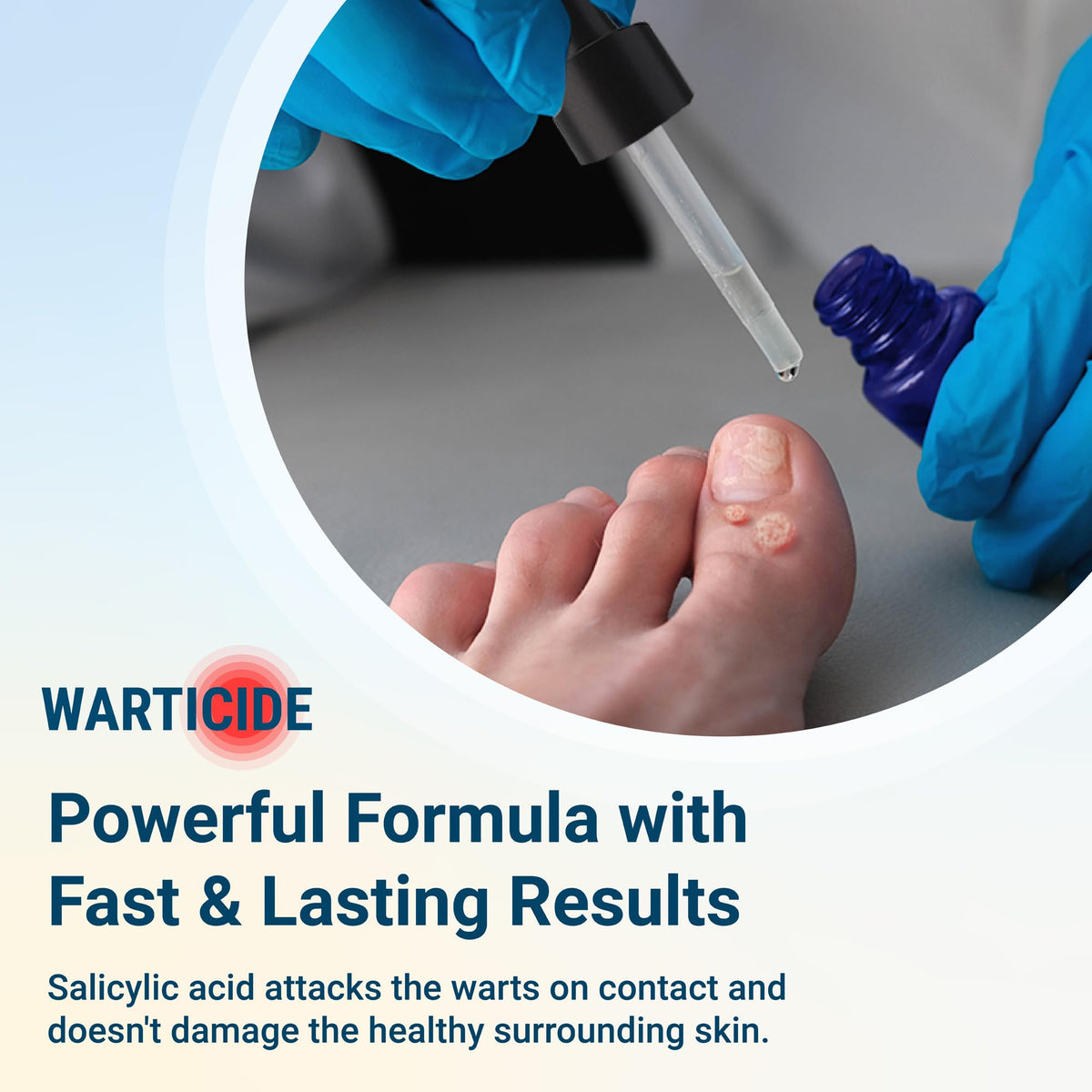 Warticide Liquid Wart Remover β 10% Salicylic Acid with Tea Tree & Cedar Leaf Oil | Made in USA | 1 Fl Oz Dropper