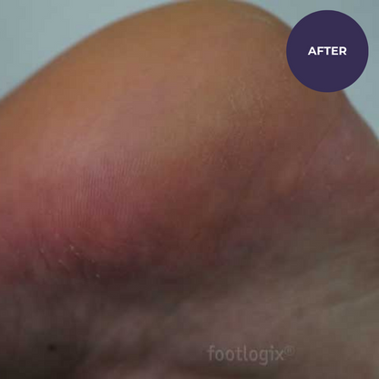 Footlogix DD Cream Mousse Formula (125ml)