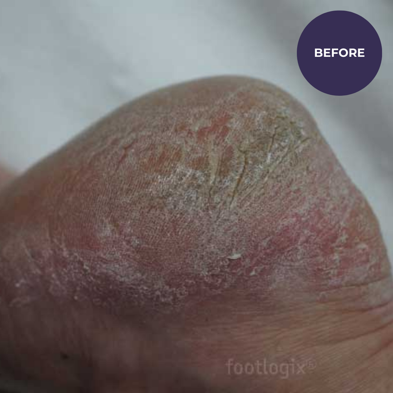 Footlogix DD Cream Mousse Formula (125ml)