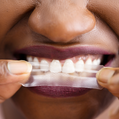 مجموعة شرائط تبييض الأسنان المتقدمة PAP-X™ من شركة تووز