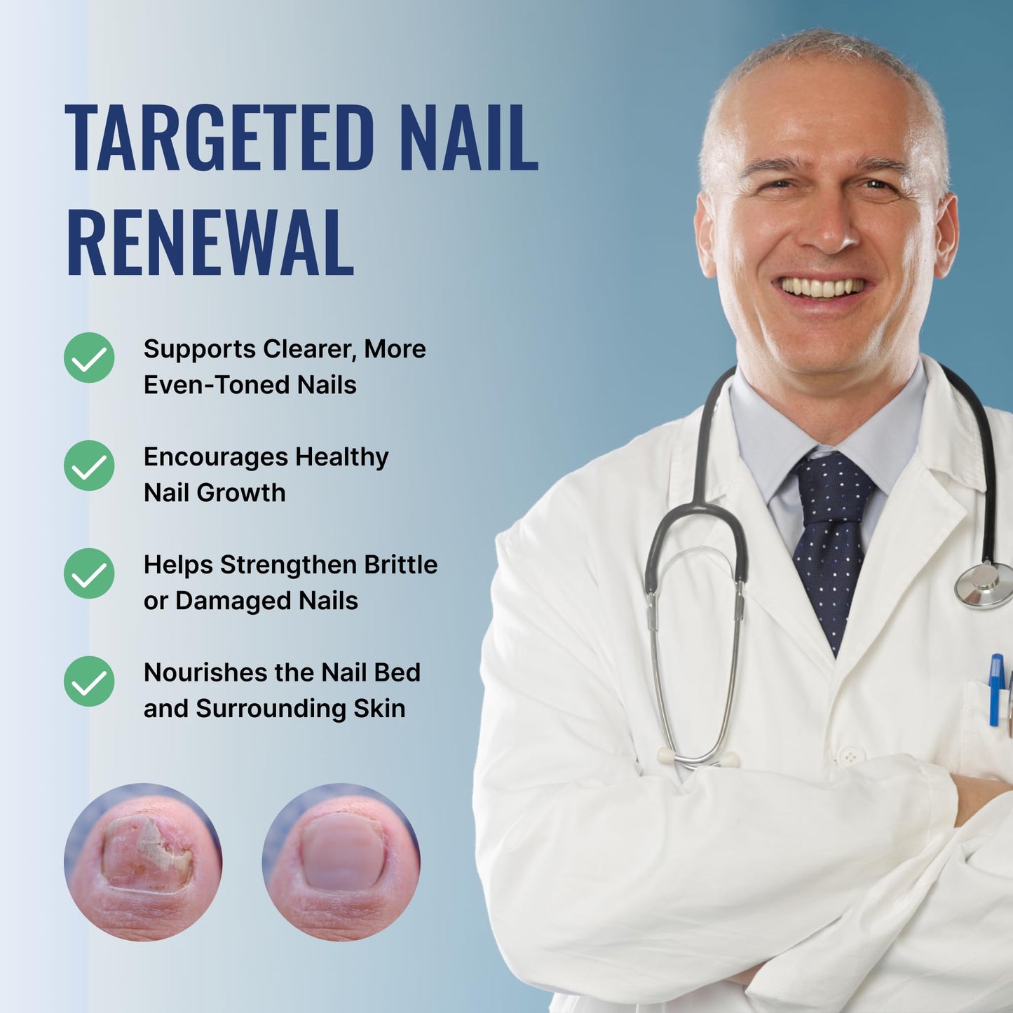 Approved Science Fungix 25% Undecylenic Acid – Extra Strength Nail Fungus Treatment with Tea Tree Oil | Pack of 2