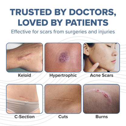 BIODERMIS PROSIL Silicone Scar Stick 4.25g | Glide-On, Mess-Free Scar Care