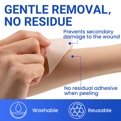 Bioemmalab Silicone Scar Sheets - Medical Grade Tape Roll (1.6" x 150") for Post-Surgical, Acne & Keloid Scars