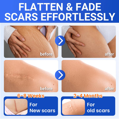 Bioemmalab Silicone Scar Sheets – Surgical Tape (1.6”x120” Roll) for Face & Post-Surgery