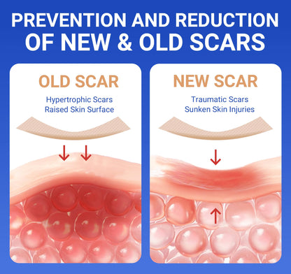Bioemmalab Silicone Scar Sheets – Surgical Tape (1.6”x120” Roll) for Face & Post-Surgery