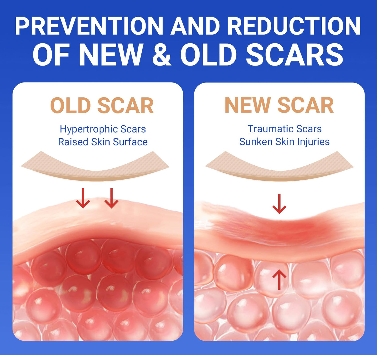 Bioemmalab Silicone Scar Sheets – Surgical Tape (1.6”x120” Roll) for Face & Post-Surgery