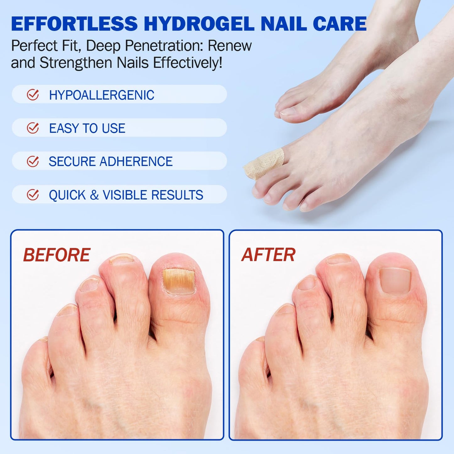 Cacukn Toenail Treatment Extra Strength – 2 Pack Nail Repair Patches (42 Pcs) | Overnight Renewal