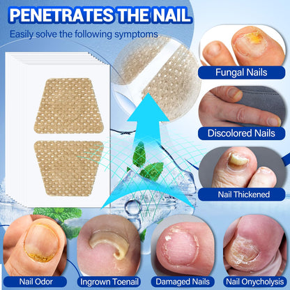 Comfort Toenail Fungus Patches - Extra Strength Hydrogel Overnight Nail Repair (50 Pcs)