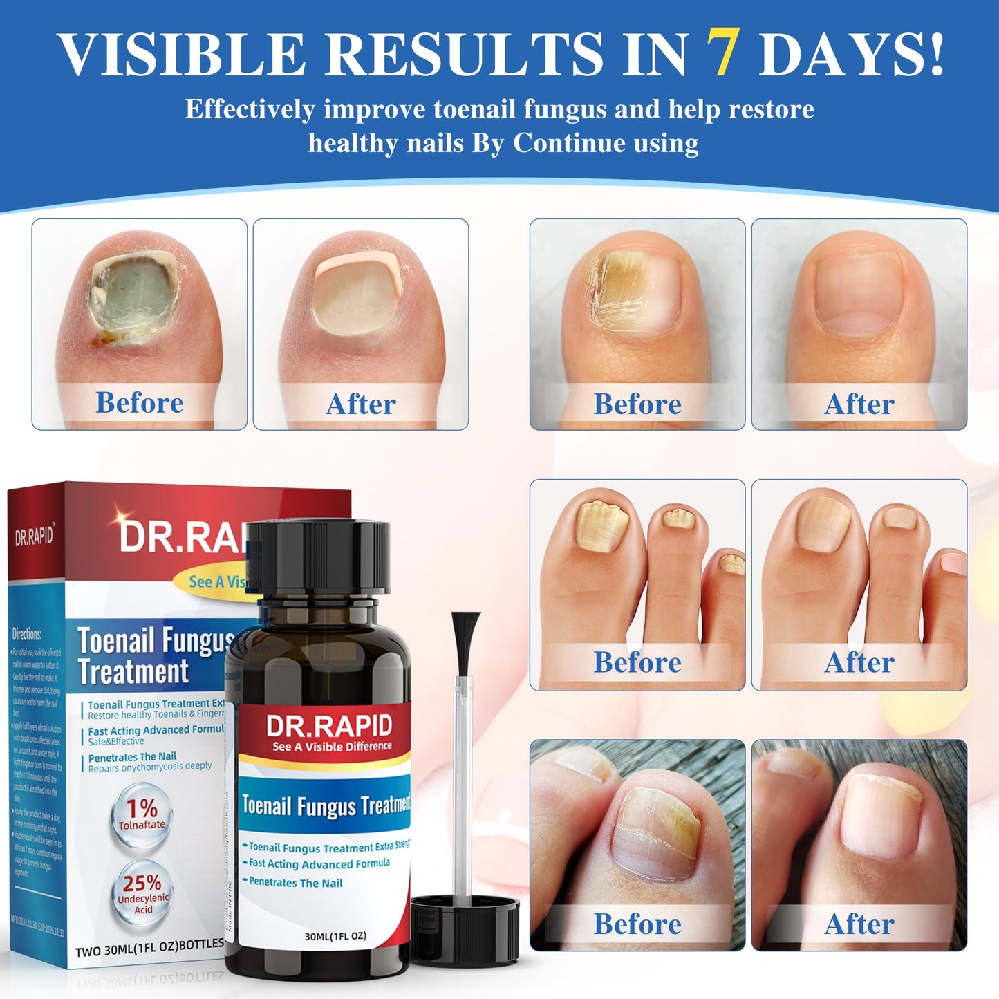 DR.RAPID Toenail Fungus Treatment Extra Strength - Fast-Acting Nail Repair with Tea Tree Oil