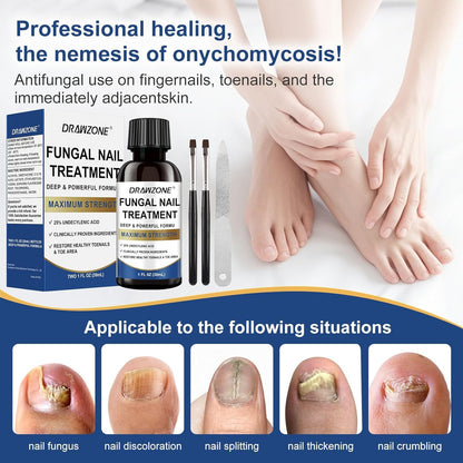 Drawzone Toenail Fungus Treatment Extra Strength – 25% Undecylenic Acid, Nail Renewal