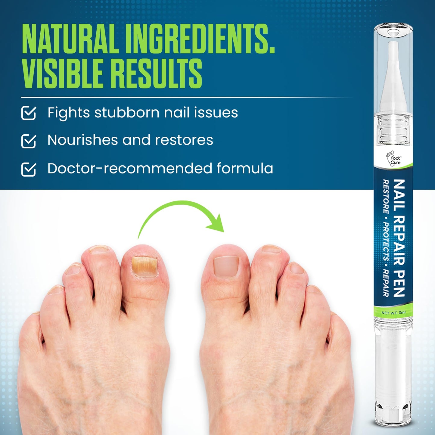 Foot Cure Nail Repair Pen – Extra Strength Toenail Fungus Treatment (USA Made)