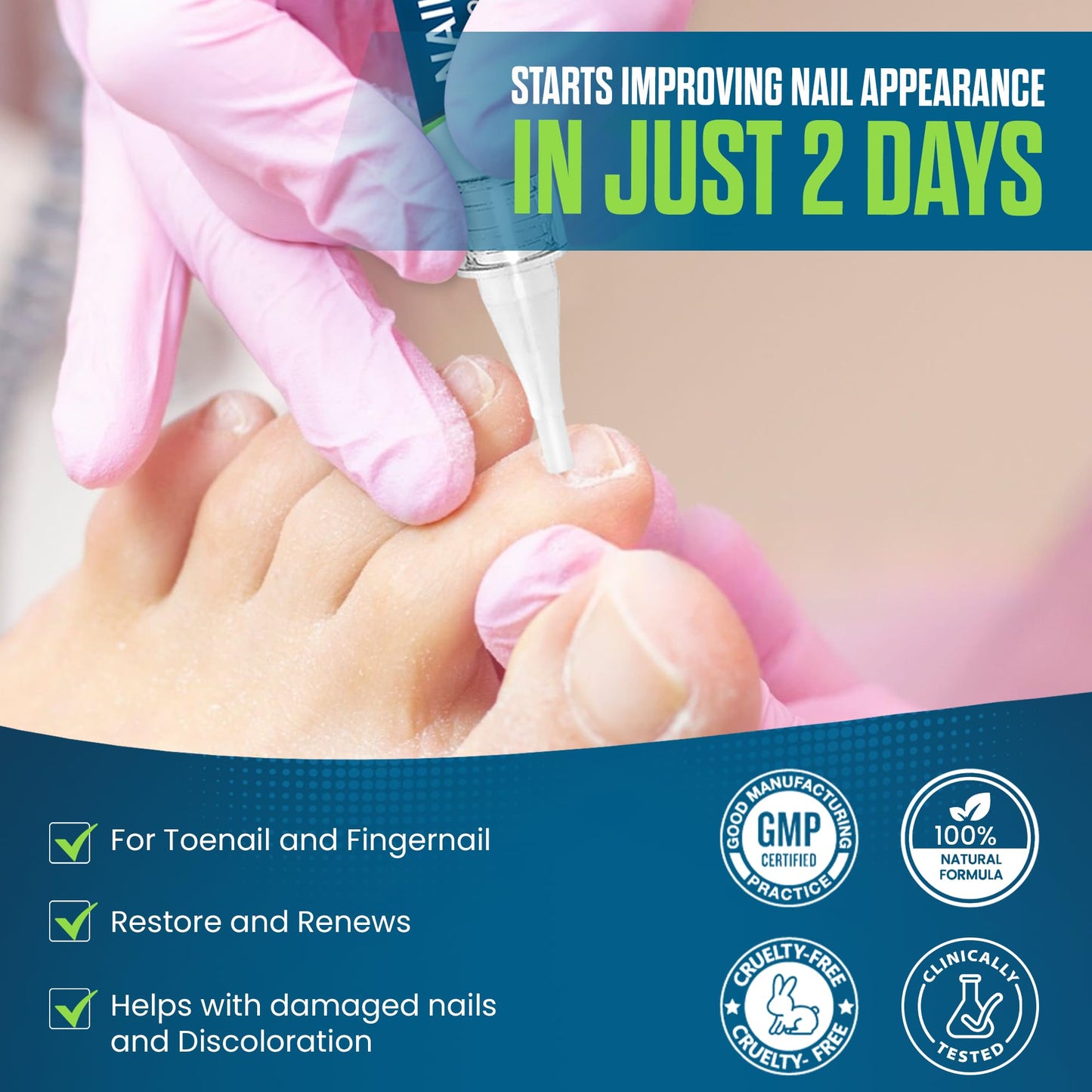 Foot Cure Nail Repair Pen – Extra Strength Toenail Fungus Treatment (USA Made)