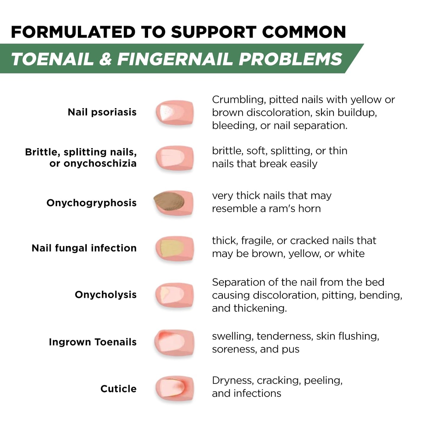 Foot Cure Toenail Fungus Treatment Extra Strength – Athletes Foot & Damaged Nail Repair | Made in USA