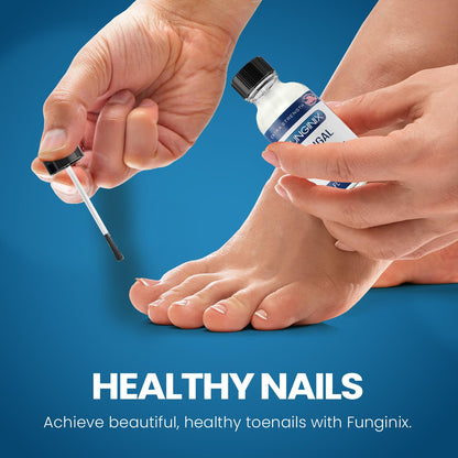 FUNGINIX Toenail Fungus Treatment Extra Strength – 10% Undecylenic Acid + Tea Tree Oil (Made in USA)