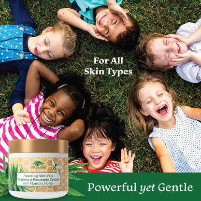 Green Leaf Naturals Manuka Honey Eczema Cream – Moisturizing Lotion (4oz)