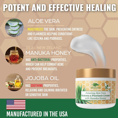 Green Leaf Naturals Manuka Honey Eczema Cream – Moisturizing Lotion (4oz)