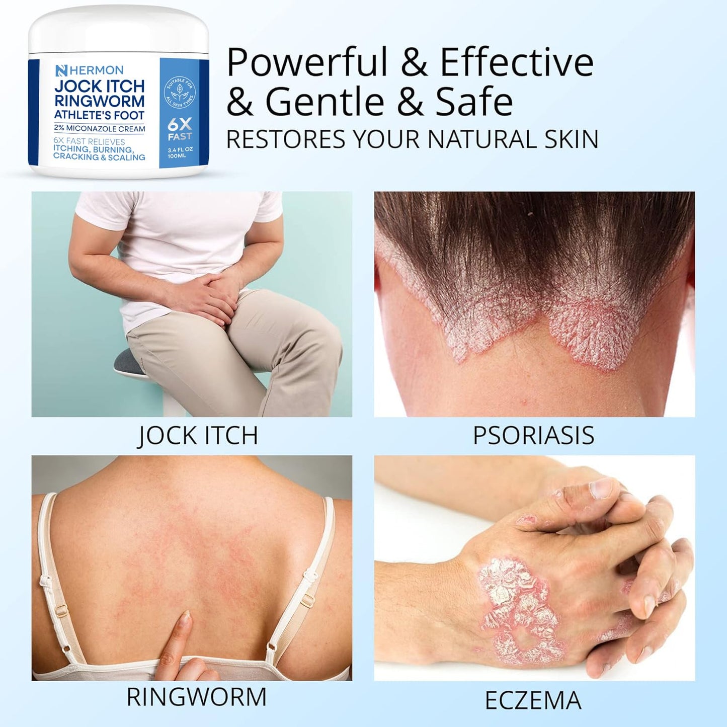 Hermon Jock Itch Cream - Antifungal Ringworm & Psoriasis Treatment for Humans, 100ml