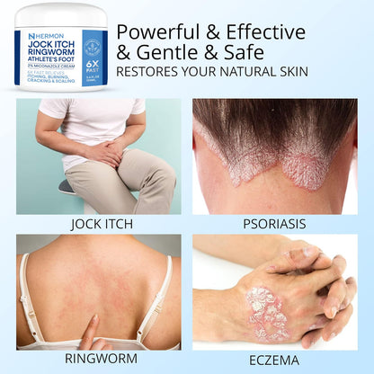 Hermon Jock Itch Cream - Antifungal Ringworm & Psoriasis Treatment for Humans, 100ml