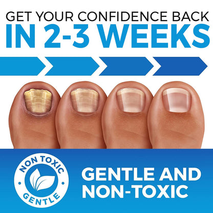 Imperial Feet Toe & Toenail Fungus Treatment – FDA Registered, Extra Strength Nail Care (USA)