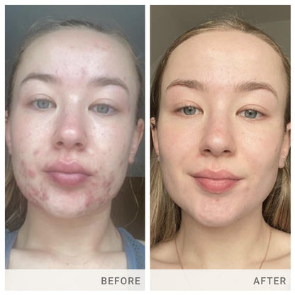 Jane Iredale Skin Accumax Supplement by Advanced Nutrition Programme – 60-Day Supply (Vegan, Gluten-Free)