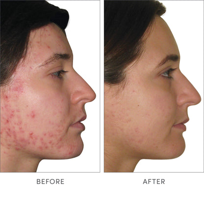 Skin Accumax 14 Week Reset – 14 Week Supply by Advanced Nutrition Programme, distributed by jane iredale