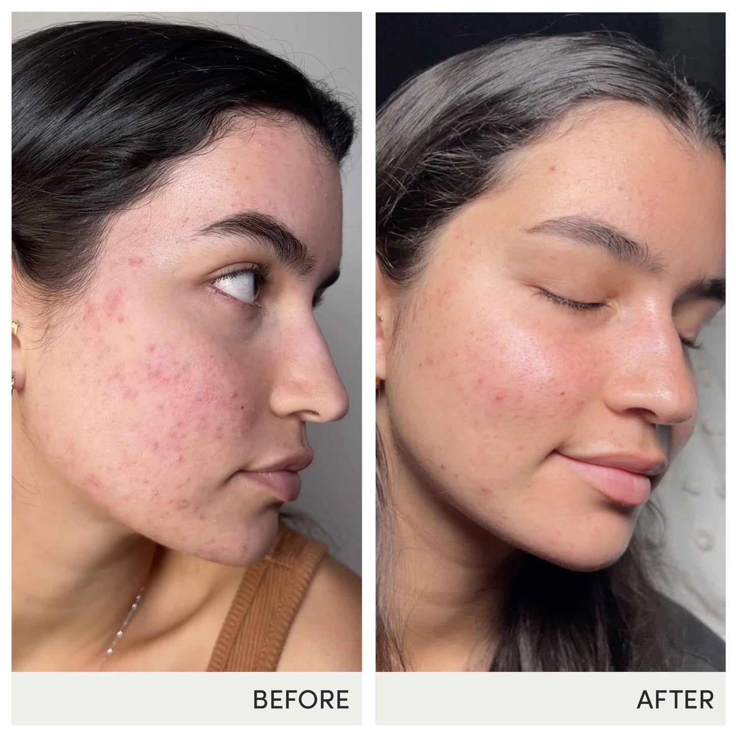 Jane Iredale Skin Accumax Supplement by Advanced Nutrition Programme – 60-Day Supply (Vegan, Gluten-Free)