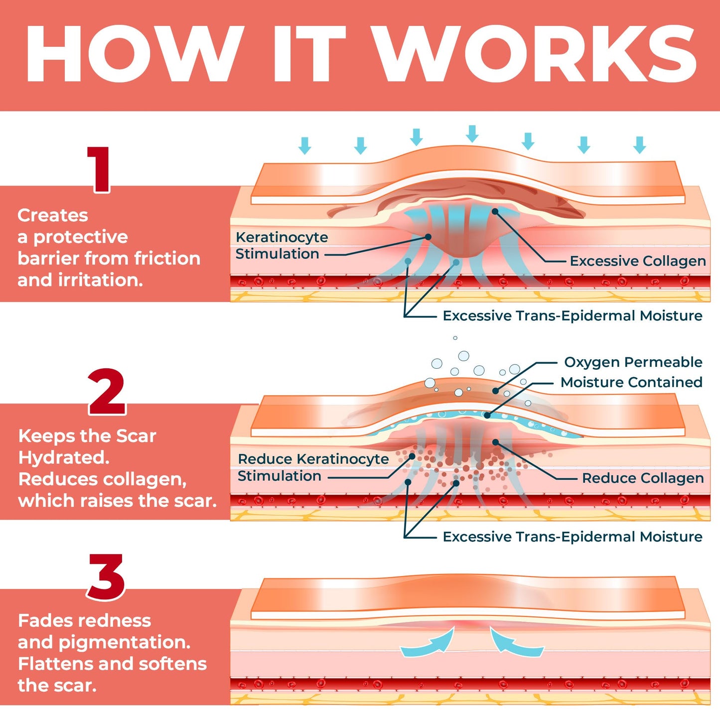 MYHELP Medical Grade Silicone Scar Sheets – Transparent 6pk (7in x 1.6in) for C-Section Scars
