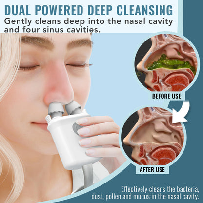 NASALFRESH MD Premium Bundle Dual Powered Nasal Irrigation System | USB Rechargeable, 60 Saline Packets
