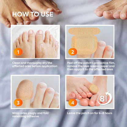 Natural Vine Toenail Fungus Patches — Extra Strength 1% Tolnaftate, 8-Hour Night Renewal | 32 Patches