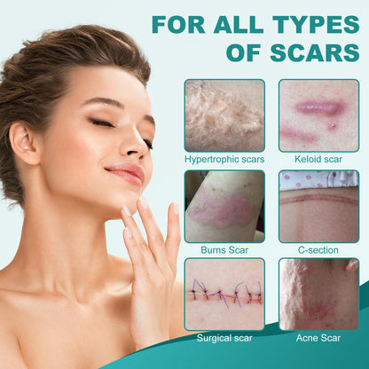 Nullam Silicone Scar Sheets & Tape Roll (1.6 x 59 in) for Surgical, C-Section & Keloid Scars