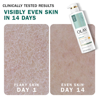 Olay Skin Solutions Hydrating Body Wash with Salicylic Acid – 4 x 17.9 fl oz