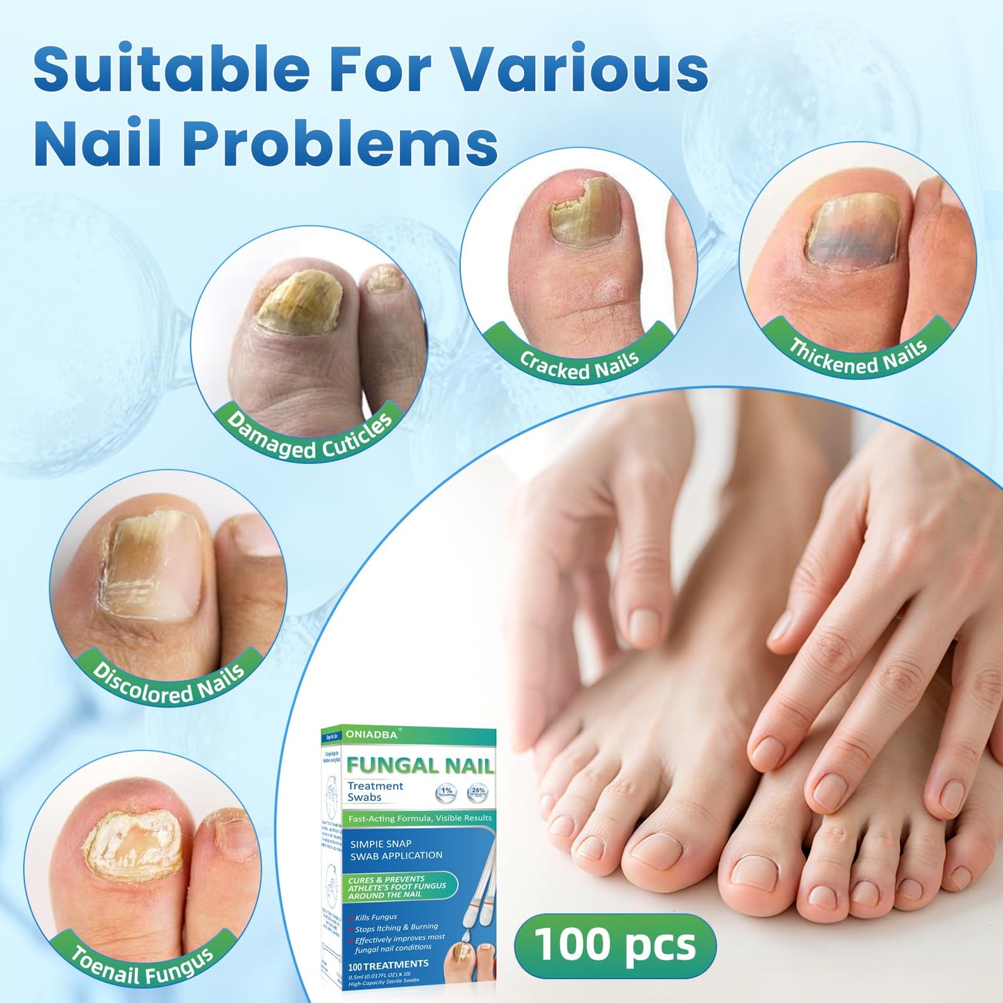 ONIADBA Fungal Nail Treatment Swabs – 100 Ct Extra Strength Toenail & Athlete’s Foot with 25% Undecylenic Acid