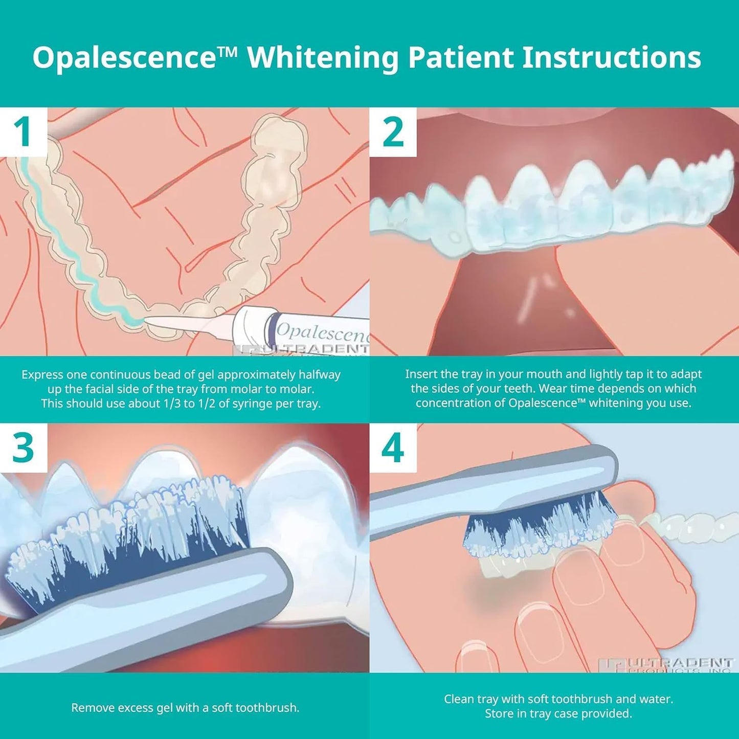 Opalescence 35% PF Whitening Refill Kit – 4 Syringes | Ultradent A-5197-2