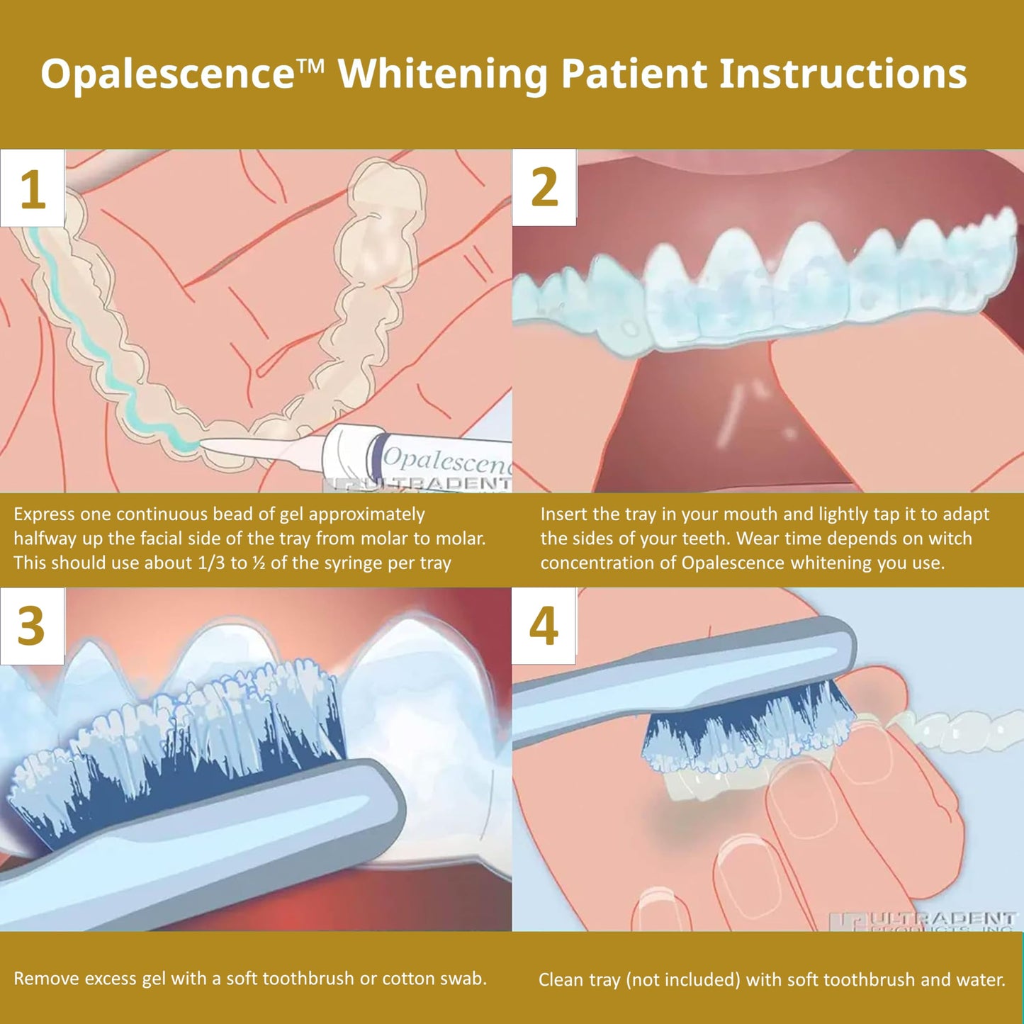 Opalescence 45% Teeth Whitening Gel Refills (12 Syringes) – Mint by Ultradent