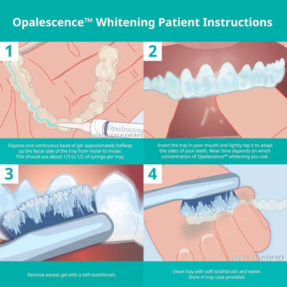 Opalescence 35% CP Mint Gel Syringes Refill Kit (4 Syringes) – Ultradent 5197-2tb
