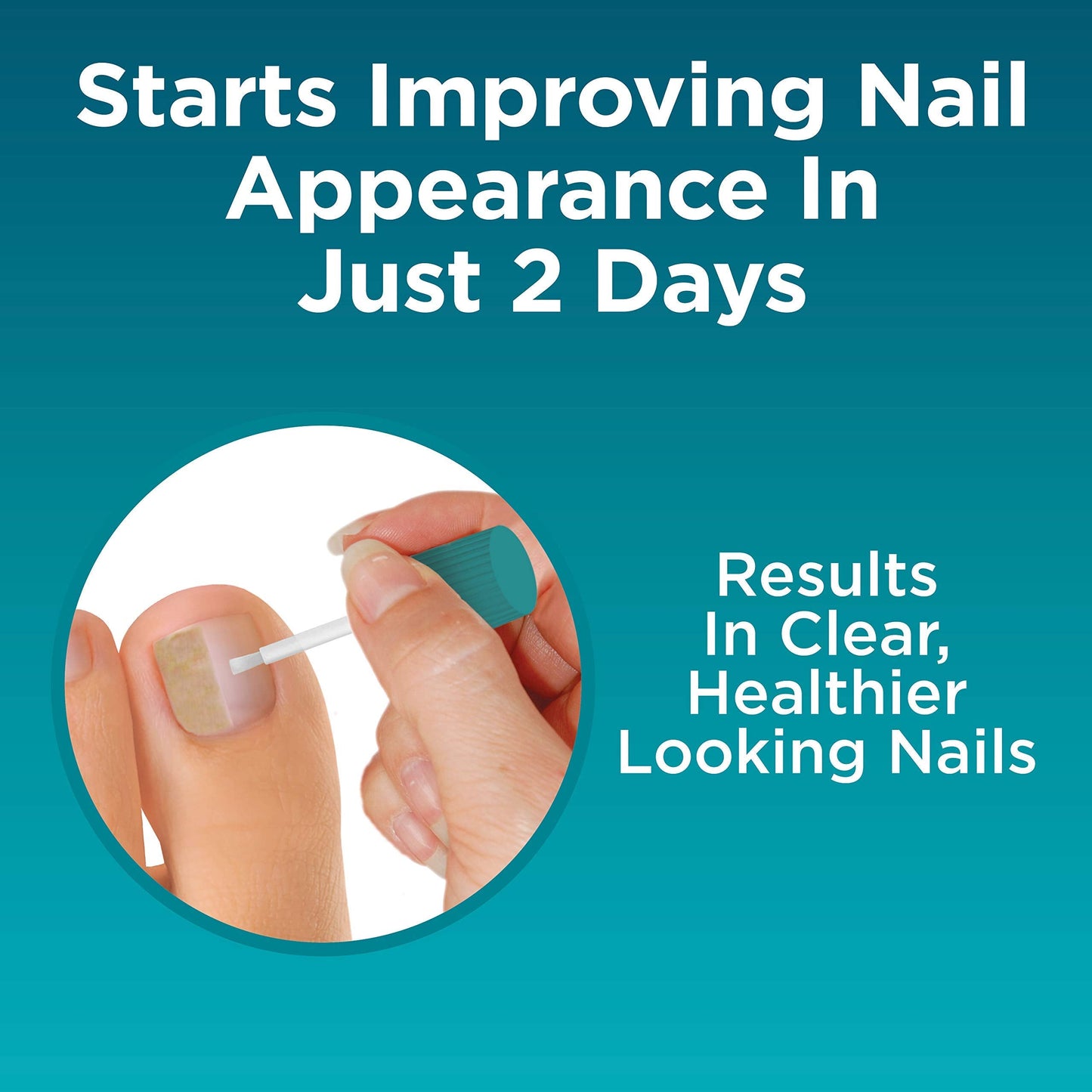 Opti-Nail 2-in-1 Toe Nail Fungus Treatment — Improve Appearance & Fight Fungus