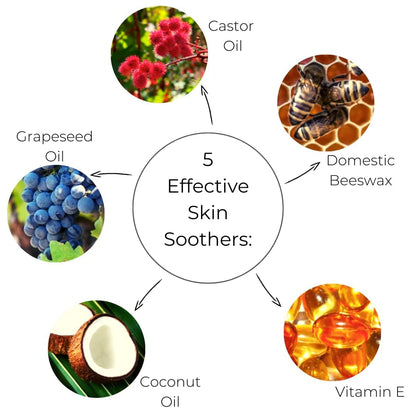 Ora's Amazing Herbal Touchy Skin Salve – Sensitive Skin Eczema Cream (4 oz)